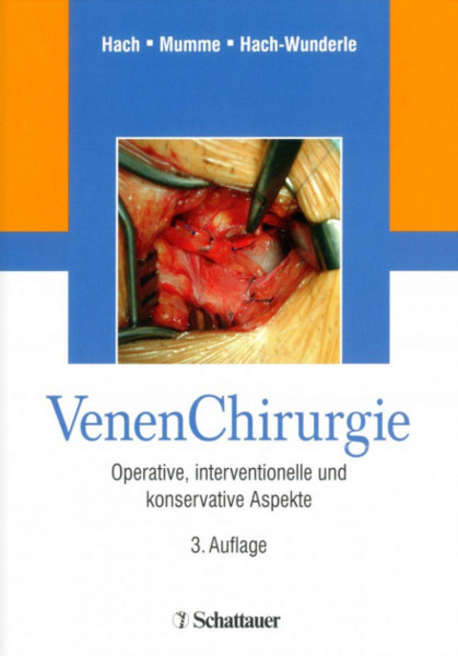 VenenChirurgie