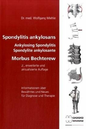 Spondylitis ankylosans - Ankylosing Spondylitis - Spondylite ankylosante - Morbus Bechterew