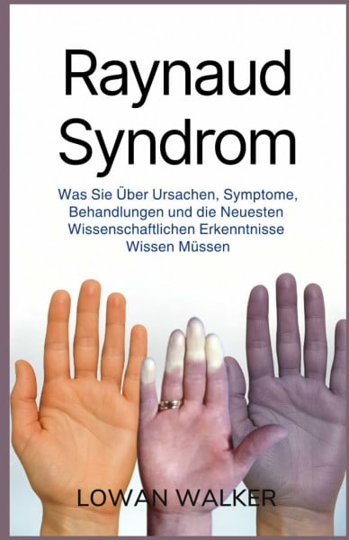 Raynaud-Syndrom: Was Sie über Ursachen, Symptome, Behandlungen und die neuesten wissenschaftlichen Erkenntnisse wissen müssen
