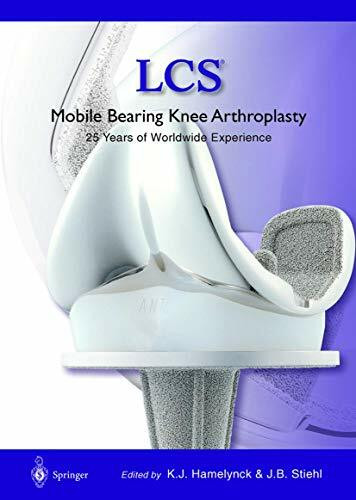 LCS® Mobile Bearing Knee Arthroplasty: A 25 Years Worldwide Review