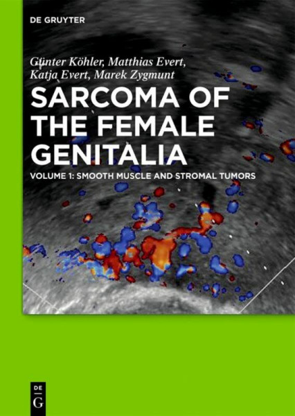 Smooth muscle and stromal tumors and prevention of inadequate surgery (Sarcoma of the Female Genitalia)