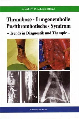 Thrombose - Lungenembolie - Postthrombotisches Syndrom: Trends in Diagnostik und Therapie