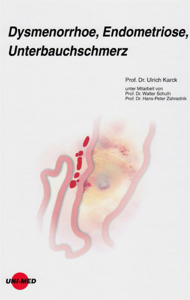 Dysmenorrhoe, Endometriose, Unterbauchschmerz