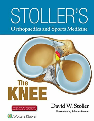 Stoller's Orthopaedics and Sports Medicine: The Knee: Includes Stoller Lecture Videos and Stoller Notes, the full text in ebook format