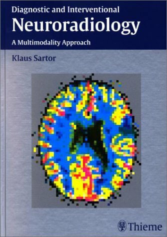 Diagnostic and Interventional Neuroradiology: A Multimodality Approach