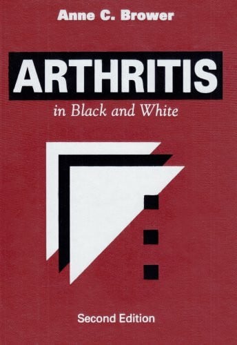 Arthritis in Black and White