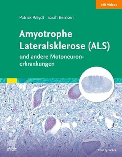 Amyotrophe Lateralsklerose (ALS) und andere Motoneuronerkrankungen: Das Wichtigste für Ärztinnen und Ärzte aller Fachrichtungen (Elsevier Essentials)