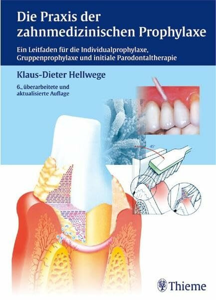 Die Praxis der zahnmedizinischen Prophylaxe: Ein Leitfaden f. d. Individual-, Gruppenprophylaxe u. initiale Parodontaltherapi: Ein Leitfaden für die ... und initiale Parodontaltherapie (ZMK Praxis)