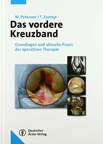 Das vordere Kreuzband: Grundlagen und aktuelle Praxis der operativen Therapie