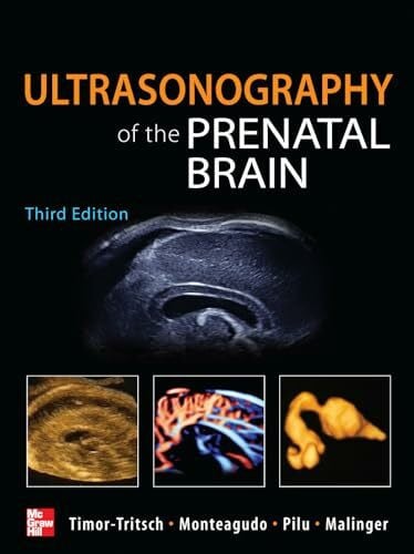 Ultrasonography of the Prenatal Brain (Medicina)