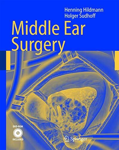 Middle Ear Surgery Middle Ear Surgery