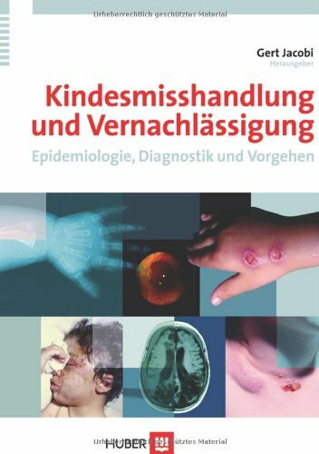 Kindesmisshandlung und Vernachlässigung: Epidemiologie, Diagnostik und Vorgehen