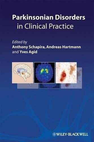 Parkinson's Disease in Daily Practice