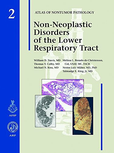 Non-Neoplastic Disorders of the Lower Respiratory Tract (Atlas of Nontumor Pathology)