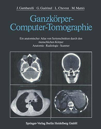 Ganzkörper-Computer-Tomographie: Ein anatomischer Atlas von Serienschnitten durch den menschlichen Körper Anatomie ― Radiologie ― Scanner