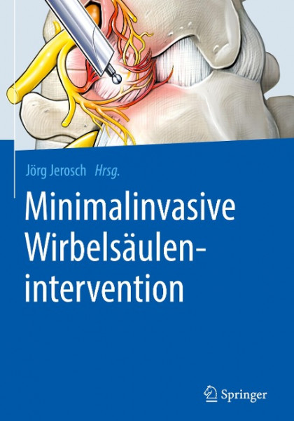 Minimalinvasive Wirbelsäulenintervention