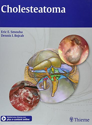 Cholesteatoma: Surgical Decision Making, Issues, and Controversies. With E-Book