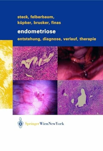 Endometriose: Entstehung, Diagnose, Verlauf und Therapie