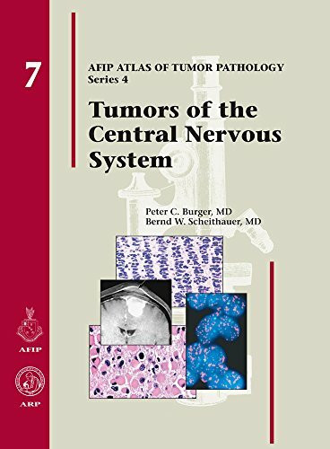 Tumors of the Central Nervous System (Afip Atlas of Tumor Pathology, Band 4)