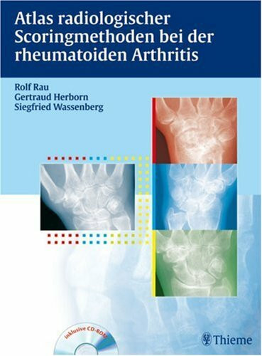 Atlas der Scoringmethoden bei der rheumatoiden Arthritis: Inkl. CD-ROM mit Buch als pdf