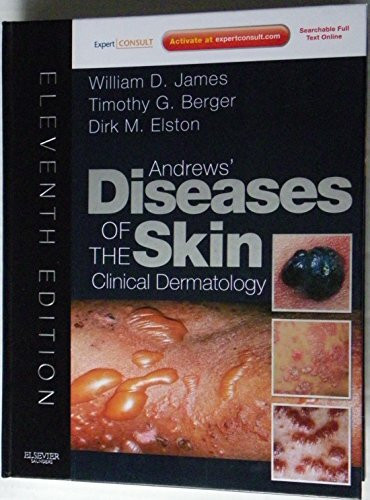 Andrews' Diseases of the Skin: Clinical Dermatology. Expert Consult