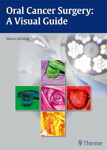 Oral Cancer Surgery: A Visual Guide