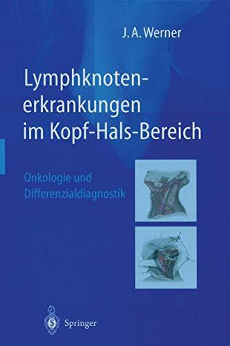 Lymphknotenerkrankungen im Kopf-Hals-Bereich: Onkologie und Differenzialdiagnostik