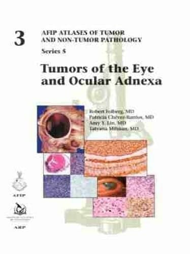 Tumors of the Eye and Ocular Adnexa (AFIP Atlas of Tumor and Non-Tumor Pathology, Series 5, Band 3)
