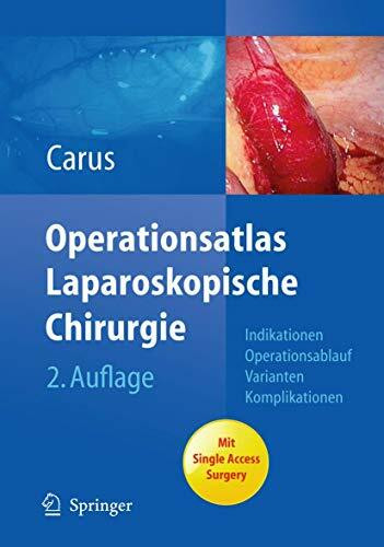 Operationsatlas Laparoskopische Chirurgie: Indikationen - Operationsablauf - Varianten - Komplikationen Mit Single Access Surgery
