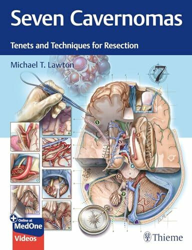 Seven Cavernomas: Tenets and Techniques for Resection