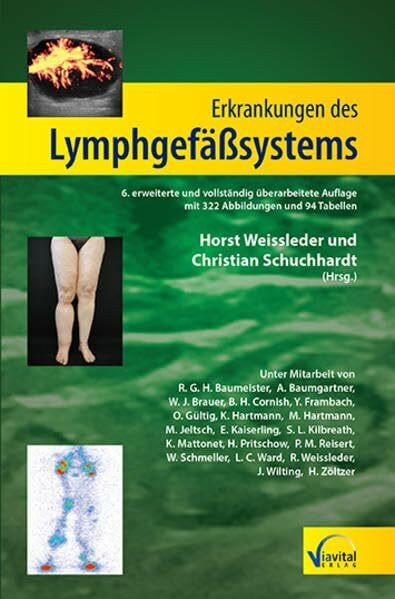 Erkrankungen des Lymphgefäßsystems