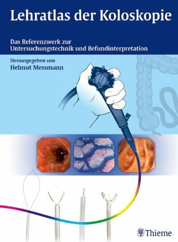 Lehratlas der Koloskopie: Das Referenzwerk zur Untersuchungstechnik und Befundinterpretation