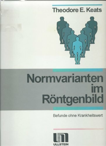 Normvarianten im Röntgenbild. Befunde ohne Krankheitswert