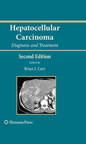 Hepatocellular Carcinoma: Diagnosis and Treatment (Current Clinical Oncology)