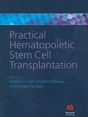 Practical Hematopoietic Stem Cell Transplantation
