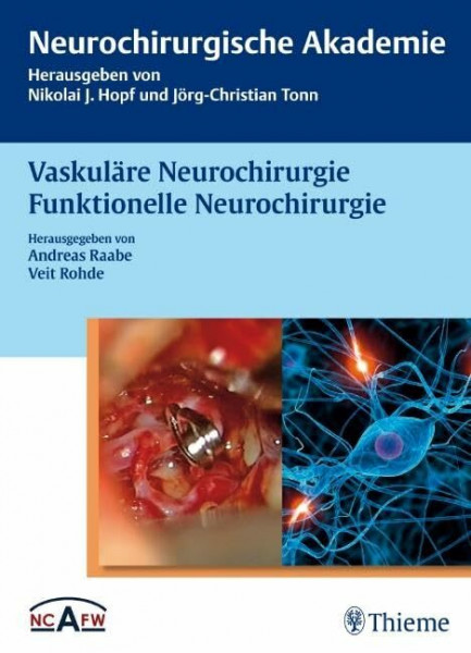 Vaskuläre Neurochirurgie Funktionelle Neurochirurgie (Neurochirurgische Akademie)