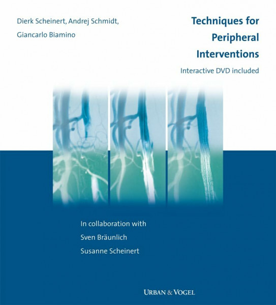 Tips, Tricks and new Technics for peripheral Interventions