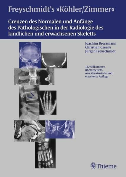 Freyschmidts Köhler/Zimmer: Grenzen des Normalen und Anfänge des Pathologischen: Joachim Brossmann, Christian Czerny, Jürgen Freyschmidt