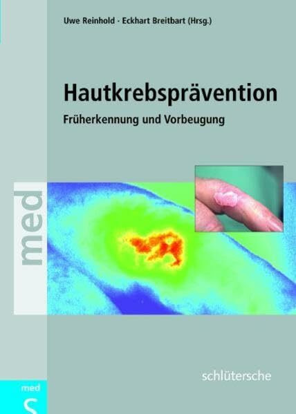 Hautkrebsprävention: Früherkennung und Vorbeugung