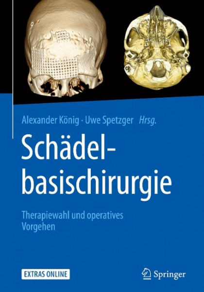 Schädelbasischirurgie