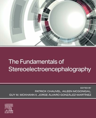 The Fundamentals of Stereoelectroencephalography The Fundamentals of Stereoelectroencephalography