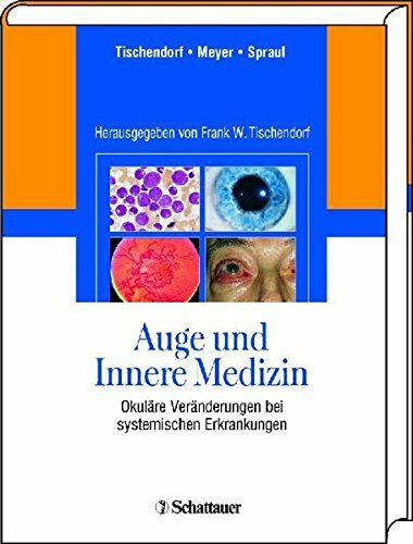 Auge und Innere Medizin: Okuläre Veränderungen bei systemischen Erkankungen