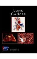 Lung Cancer, w. CD-ROM: ACS Atlas of Clinical Oncology (American Cancer Society Atlas of Clinical Oncology)