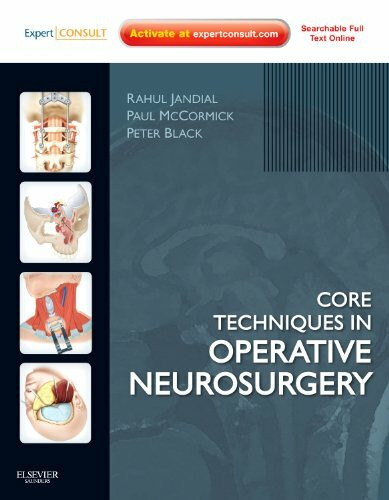 Core Techniques in Operative Neurosurgery: Expert Consult - Online and Print