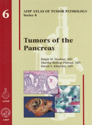 Tumors of the Pancreas (Afip Atlas of Tumor Pathology; 4th Series Fascicle 6)