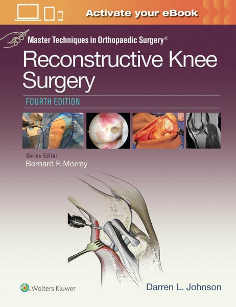 Master Techniques in Orthopaedic Surgery: Reconstructive Knee Surgery, 4 Vols.