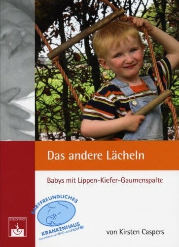 Das andere Lächeln. Babys mit Lippen-Kiefer-Gaumenspalte