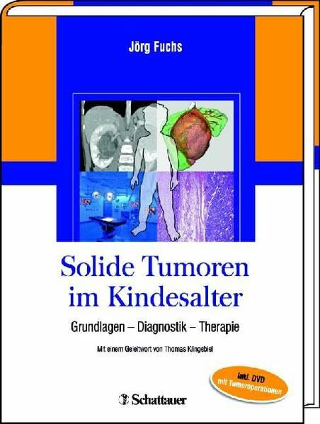 Solide Tumoren im Kindesalter: Grundlagen – Diagnostik – Therapie - Inkl. DVD mit mehr als 15 Tumoroperationen: Grundlagen, Diagnostik, Therapie. Vorwort: Klingebiel, Thomas