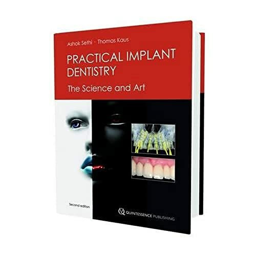 Practical Implant Dentistry: The Science and Art