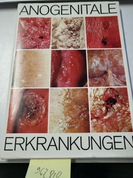 Anogenitale Erkrankungen. Regio anogenitalis. Makroskopische Diagnostik